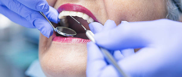 Best Emergency Treatment for Toothache in Towaoc, CO